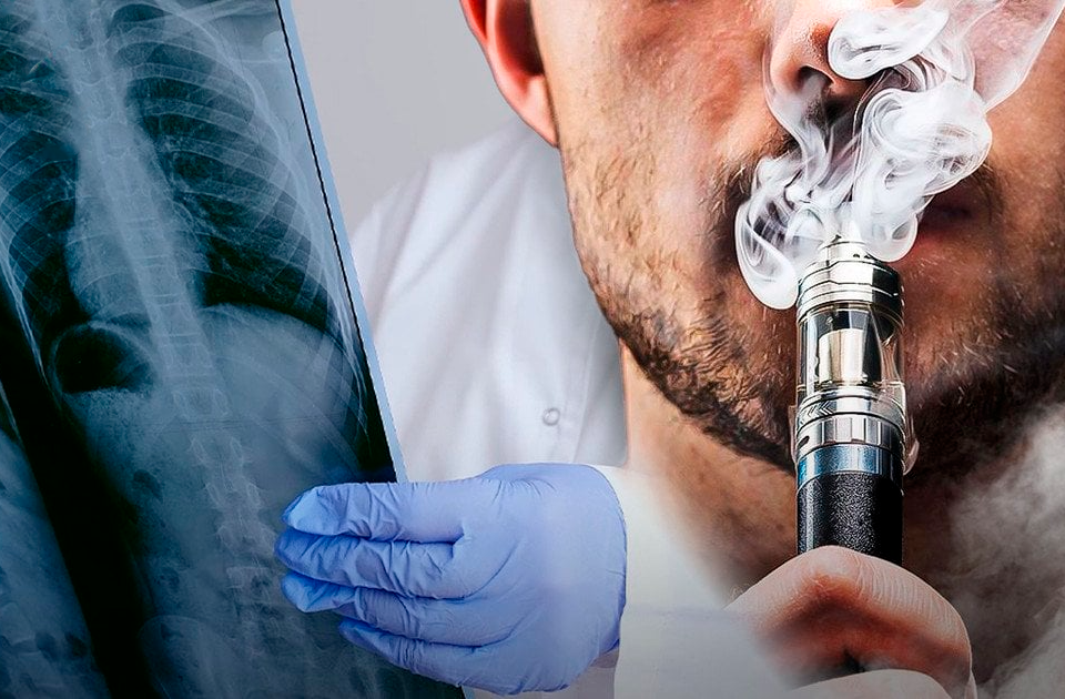 Электронные сигареты в 2025: мнение врачей, учёных и общества (актуально)